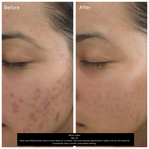 Naked Ocean Algae Face Serum Powered by BioActive AlgaRx™